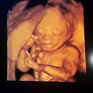 Meet your Posher, Benjamin